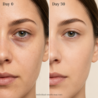 Orvelique Aurora - Red Light + Microcurrent Eye Ritual Mask