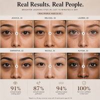 Orvelique Aurora - Red Light + Microcurrent Eye Ritual Mask